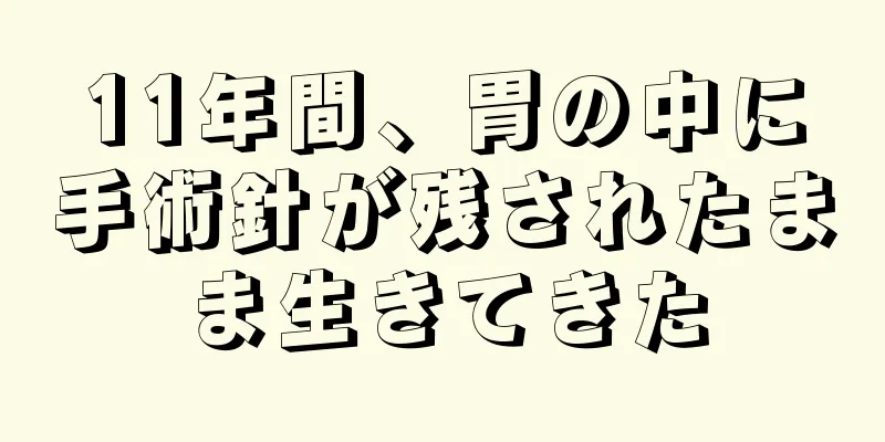 11年間、胃の中に手術針が残されたまま生きてきた