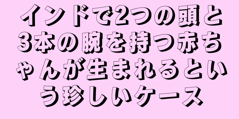 インドで2つの頭と3本の腕を持つ赤ちゃんが生まれるという珍しいケース