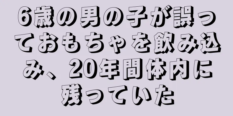 6歳の男の子が誤っておもちゃを飲み込み、20年間体内に残っていた