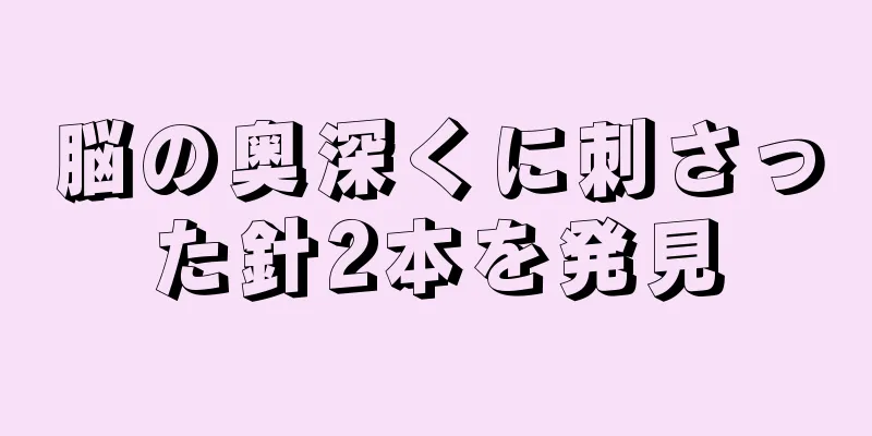 脳の奥深くに刺さった針2本を発見