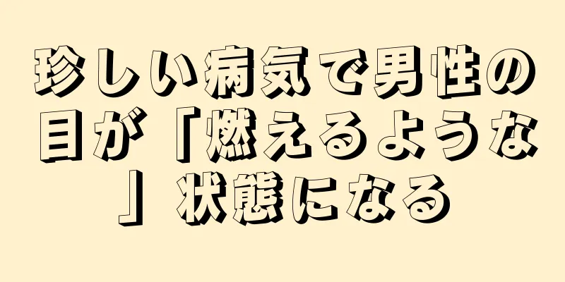 珍しい病気で男性の目が「燃えるような」状態になる